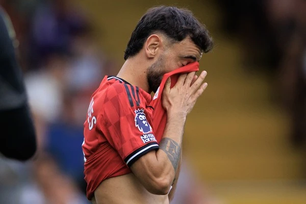 Hasil Pertandingan MU vs Brentford : Amorim Panik, Bruno Gagal Penalty