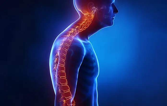 Postur tubuh tidak ideal