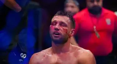 RDR Buka Suara Usai Kalah dari Brendan Allen