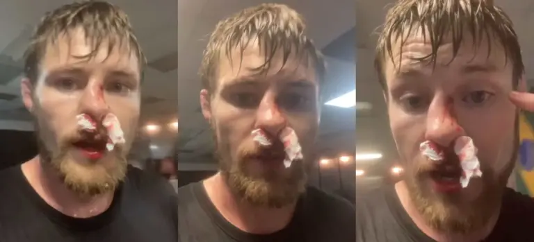 Bryce Mitchell Alami Hidung Patah, Minta Bantuan Fans